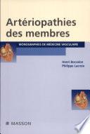 Artériopathies des membres