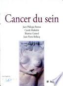 Cancer du sein