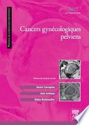 Cancers gynécologiques pelviens