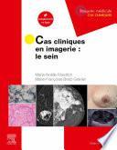 Cas cliniques en imagerie : le sein