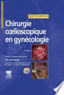 Chirurgie cœlioscopique en gynécologie