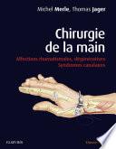Chirurgie de la main