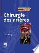 Chirurgie des artères