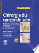Chirurgie du cancer du sein