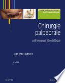 Chirurgie palpébrale