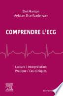 Comprendre l'ECG