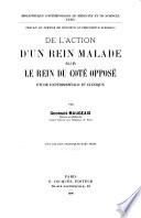 De l'action d'un rein malade sur le rein du coté opposé