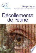 Décollements de rétine