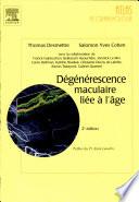 Dégénérescence maculaire liée à l'âge