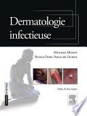 Dermatologie infectieuse
