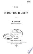 Des paralysies toxiques