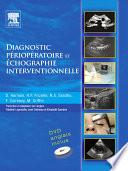 Diagnostic périopératoire et échographie interventionnelle