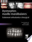 Dysmorphies maxillo-mandibulaires