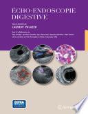 Echo-endoscopie digestive