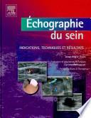 Échographie du sein