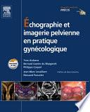 Échographie et imagerie pelvienne en pratique gynécologique