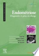 Endométriose