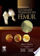 Fractures de l'extrémité proximale du fémur