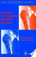 Fractures de l'extrémité proximale du fémur