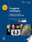 Imagerie cardiaque