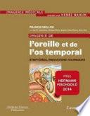 Imagerie de l'oreille et de l'os temporal