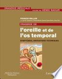Imagerie de l'oreille et de l'os temporal - Volume 6 : Symptômes, innovations techniques