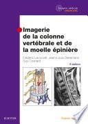 Imagerie de la colonne vertébrale et de la moelle épinière
