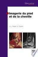 Imagerie du pied et de la cheville