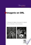 Imagerie en ORL