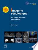 Imagerie sénologique
