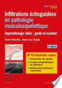 Infiltrations échoguidées en pathologie musculosquelettique