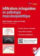 Infiltrations échoguidées en pathologie musculosquelettique