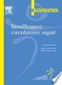 Insuffisance circulatoire aiguë