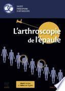 L'arthroscopie de l'épaule