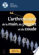 L'arthroscopie de la main, du poignet et du coude