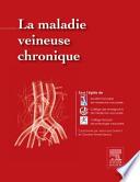 La Maladie Veineuse Chronique