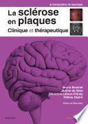 La sclérose en plaques - Clinique et thérapeutique