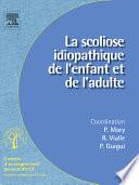 La scoliose idiopathique de l'enfant et de l'adulte