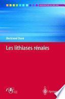 Les lithiases rénales