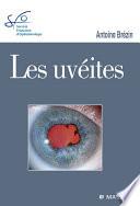 Les uvéites