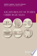 Ligatures et sutures chirurgicales