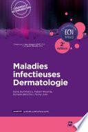Maladies infectieuses - Dermatologie