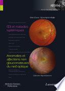 Oeil et maladies systémiques / Anomalies et affections non glaucomateuses du nerf optique (volume 5 - coffret rétine)