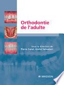 Orthodontie de l’adulte