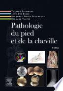 Pathologie du pied et de la cheville