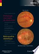 Pathologie vasculaire du fond d'oeil / Rétinopathie diabétique (volume 3 - coffret rétine)