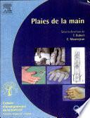 Plaies de la main