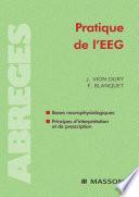 Pratique de l'EEG