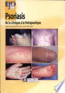 Psoriasis