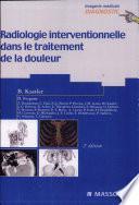 Radiologie interventionnelle dans le traitement de la douleur